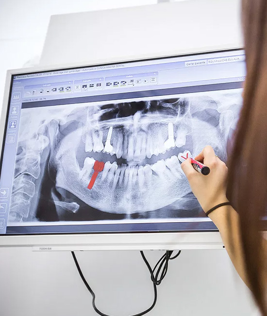 Frisco Smiles Dentistry | Implant Dentistry, Intraoral Camera and Dental Fillings